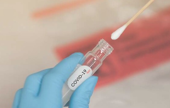 Image of COVID-19 swab