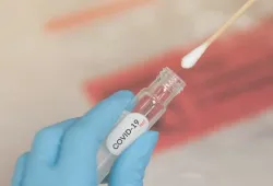 Image of COVID-19 swab